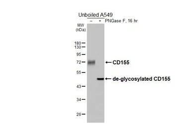 Anti-CD155 antibody [HL5910] used in Western Blot (WB). GTX647235