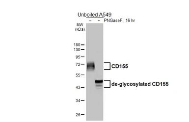 Anti-CD155 antibody [HL5911] used in Western Blot (WB). GTX647236