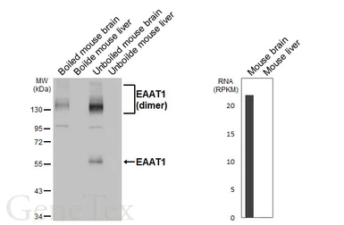 Anti-EAAT1 antibody [HL5913] used in Western Blot (WB). GTX647238