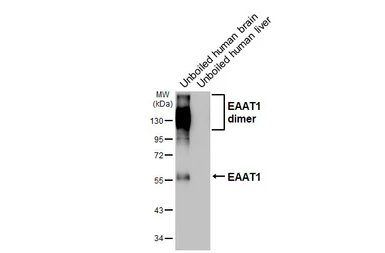 Anti-EAAT1 antibody [HL5913] used in Western Blot (WB). GTX647238