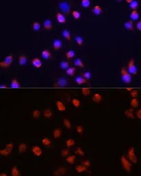 Anti-Activin Receptor Type IIA antibody used in Immunocytochemistry/ Immunofluorescence (ICC/IF). GTX64724