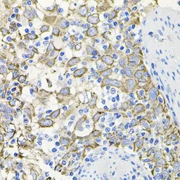 Anti-Activin Receptor Type IIA antibody used in IHC (Paraffin sections) (IHC-P). GTX64724