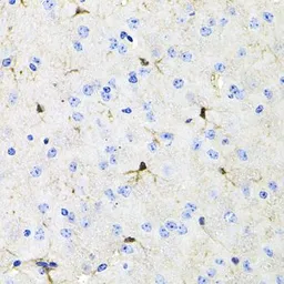 Anti-Activin Receptor Type IIA antibody used in IHC (Paraffin sections) (IHC-P). GTX64724