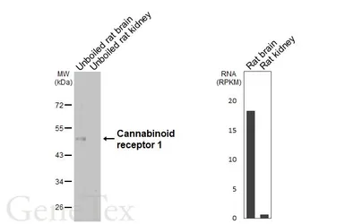 Anti-Cannabinoid receptor 1 antibody [HL5924] used in Western Blot (WB). GTX647249