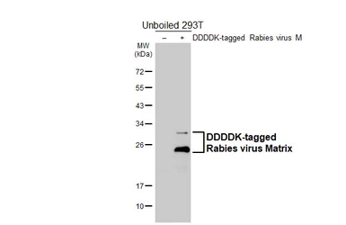 Anti-Rabies virus Matrix antibody [HL5925] used in Western Blot (WB). GTX647250