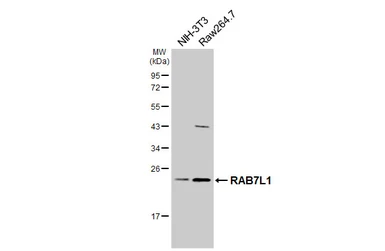 Anti-RAB7L1 antibody [HL5929] used in Western Blot (WB). GTX647254