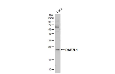Anti-RAB7L1 antibody [HL5929] used in Western Blot (WB). GTX647254