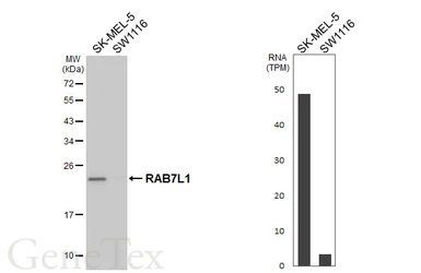 Anti-RAB7L1 antibody [HL5929] used in Western Blot (WB). GTX647254