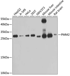 Anti-PMM2 antibody used in Western Blot (WB). GTX64726