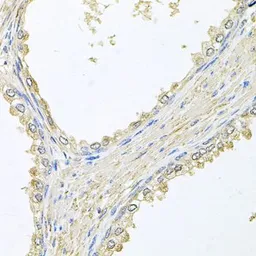 Anti-PMM2 antibody used in IHC (Paraffin sections) (IHC-P). GTX64726