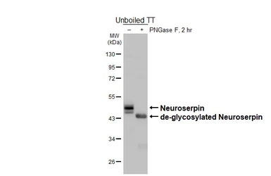 Anti-Neuroserpin antibody [HL5935] used in Western Blot (WB). GTX647260