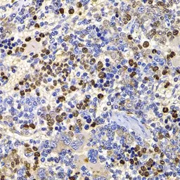 Anti-Sts1 antibody used in IHC (Paraffin sections) (IHC-P). GTX64736