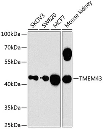 Anti-TMEM43 antibody used in Western Blot (WB). GTX64750