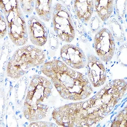 Anti-PEG10 antibody used in IHC (Paraffin sections) (IHC-P). GTX64752