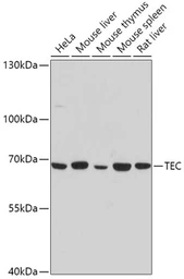 Anti-Tec antibody used in Western Blot (WB). GTX64753