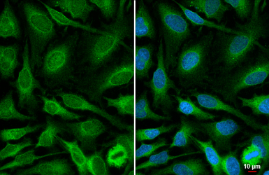 Anti-14-3-3 epsilon antibody [HL5944] used in Immunocytochemistry/ Immunofluorescence (ICC/IF). GTX647556