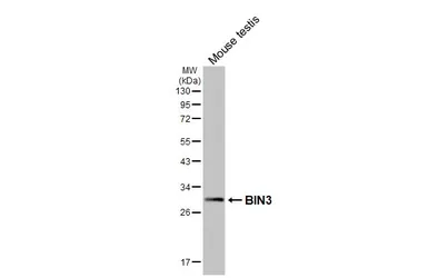 Anti-BIN3 antibody [HL5959] used in Western Blot (WB). GTX647571