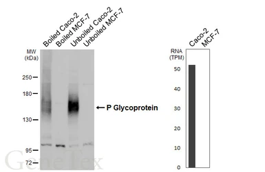 Anti-P Glycoprotein antibody [GT391] used in Western Blot (WB). GTX647572