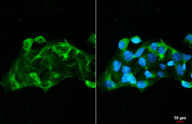 Anti-CD13 antibody [HL5964] used in Immunocytochemistry/ Immunofluorescence (ICC/IF). GTX647578