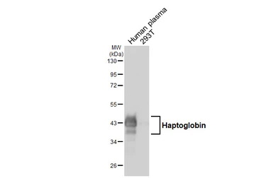 Anti-Haptoglobin antibody [HL5968] used in Western Blot (WB). GTX647582