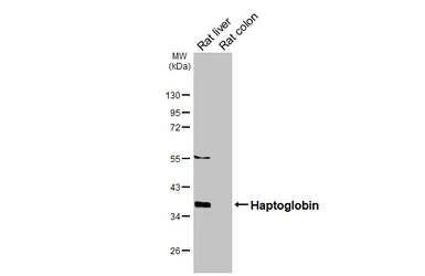 Anti-Haptoglobin antibody [HL5968] used in Western Blot (WB). GTX647582