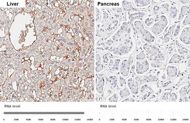 Anti-Haptoglobin antibody [HL5968] used in IHC (Paraffin sections) (IHC-P). GTX647582