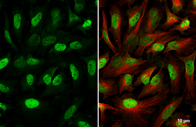 Anti-MSH2 antibody [HL5971] used in Immunocytochemistry/ Immunofluorescence (ICC/IF). GTX647585