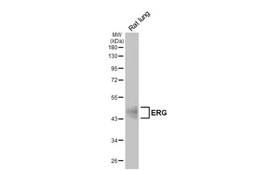 Anti-ERG antibody [HL5975] used in Western Blot (WB). GTX647589