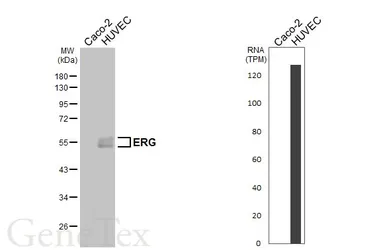 Anti-ERG antibody [HL5975] used in Western Blot (WB). GTX647589