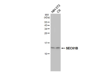 Anti-SEC61B antibody [HL5984] used in Western Blot (WB). GTX647598