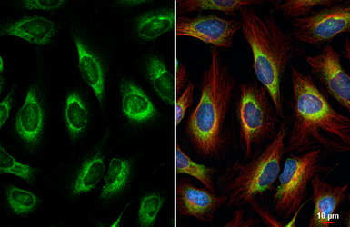 Anti-SEC61B antibody [HL5984] used in Immunocytochemistry/ Immunofluorescence (ICC/IF). GTX647598