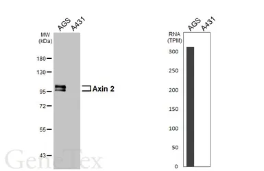 Anti-Axin 2 antibody [HL5994] used in Western Blot (WB). GTX647608
