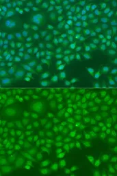 Anti-Ninein antibody used in Immunocytochemistry/ Immunofluorescence (ICC/IF). GTX64771