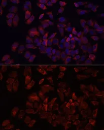 Anti-ARF5 antibody used in Immunocytochemistry/ Immunofluorescence (ICC/IF). GTX64788