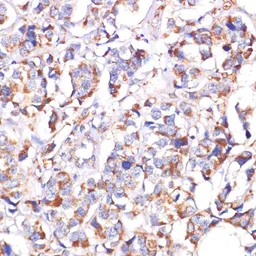Anti-STOML2 antibody used in IHC (Paraffin sections) (IHC-P). GTX64801