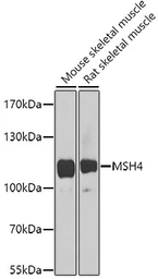 Anti-MSH4 antibody used in Western Blot (WB). GTX64804
