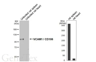 Anti-VCAM1 / CD106 antibody [HL5999] used in Western Blot (WB). GTX648073