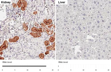 Anti-PHGDH antibody [HL6006] used in IHC (Paraffin sections) (IHC-P). GTX648080