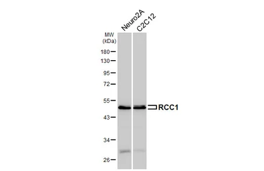 Anti-RCC1 antibody [HL6010] used in Western Blot (WB). GTX648084