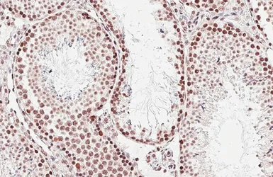Anti-RCC1 antibody [HL6010] used in IHC (Paraffin sections) (IHC-P). GTX648084