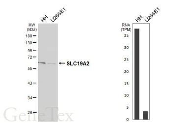 Anti-SLC19A2 antibody [HL6025] used in Western Blot (WB). GTX648099