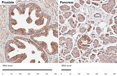 Anti-PSAP antibody [HL6041] used in IHC (Paraffin sections) (IHC-P). GTX648120