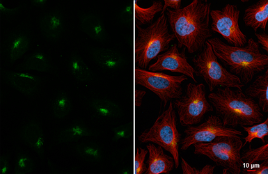 Anti-PSAP antibody [HL6041] used in Immunocytochemistry/ Immunofluorescence (ICC/IF). GTX648120