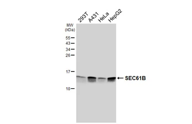Anti-SEC61B antibody [HL6048] used in Western Blot (WB). GTX648127