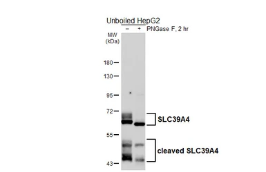Anti-SLC39A4 antibody [HL6051] used in Western Blot (WB). GTX648130