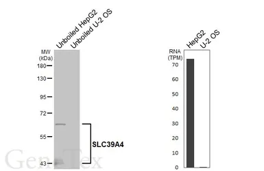 Anti-SLC39A4 antibody [HL6051] used in Western Blot (WB). GTX648130