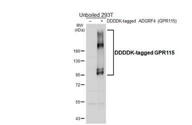 Anti-GPR115 antibody [HL6055] used in Western Blot (WB). GTX648134
