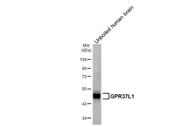 Anti-GPR37L1 antibody [HL6062] used in Western Blot (WB). GTX648141