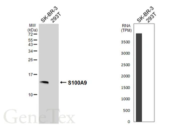 Anti-S100A9 antibody [HL6069] used in Western Blot (WB). GTX648148