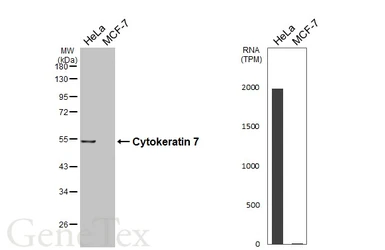 Anti-Cytokeratin 7 antibody [HL6074] used in Western Blot (WB). GTX648153